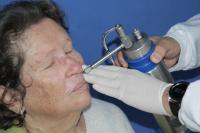 Teledermatologia agiliza atendimento de pacientes com suspeita de cncer de pele em Itaja